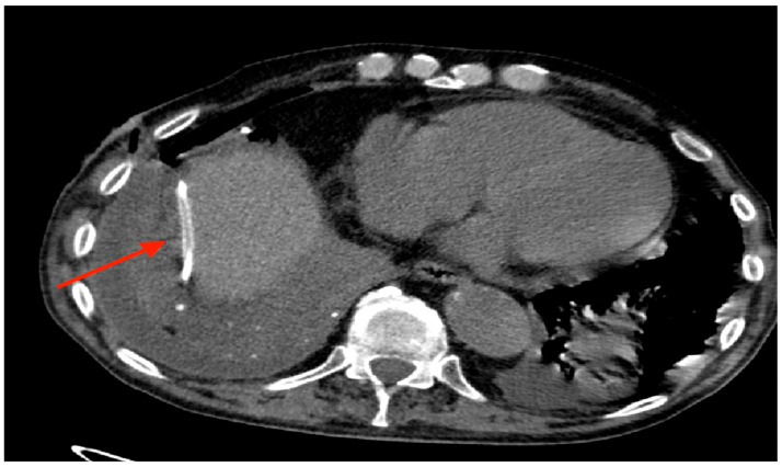 Figure 9