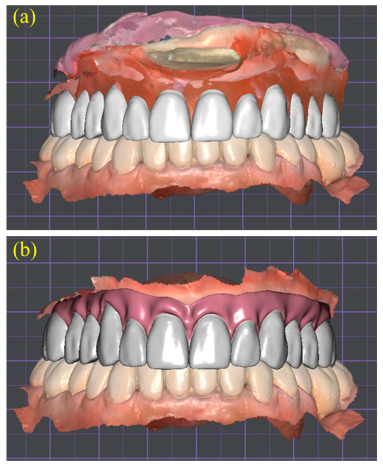 Figure 6
