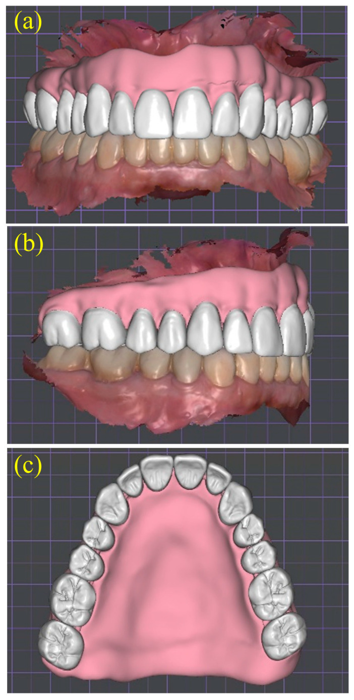 Figure 10