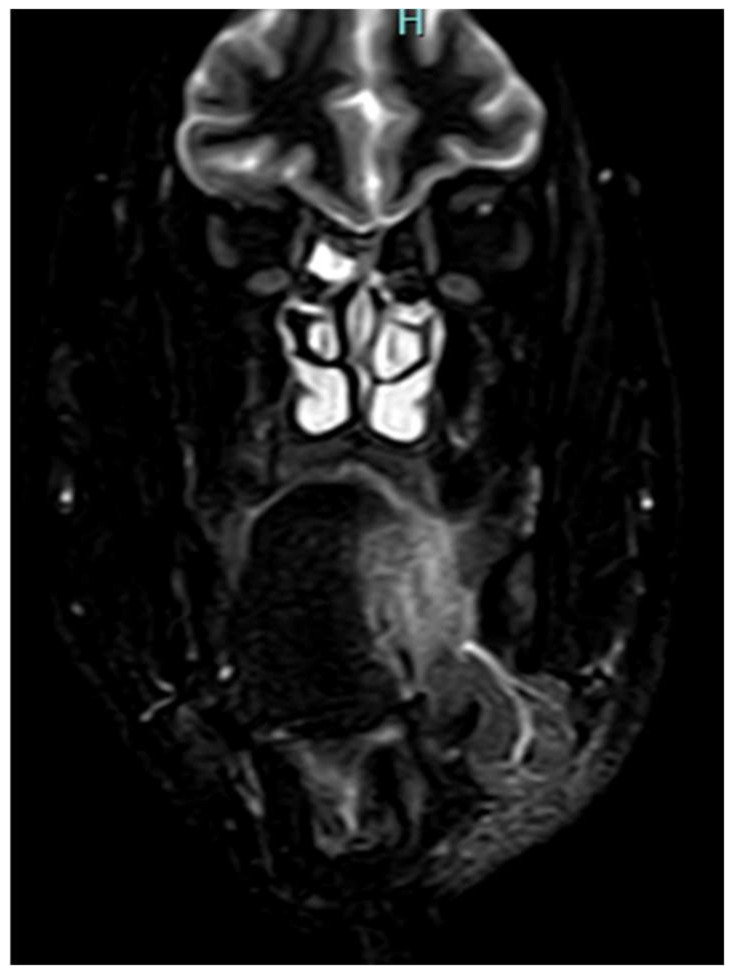 Figure 9
