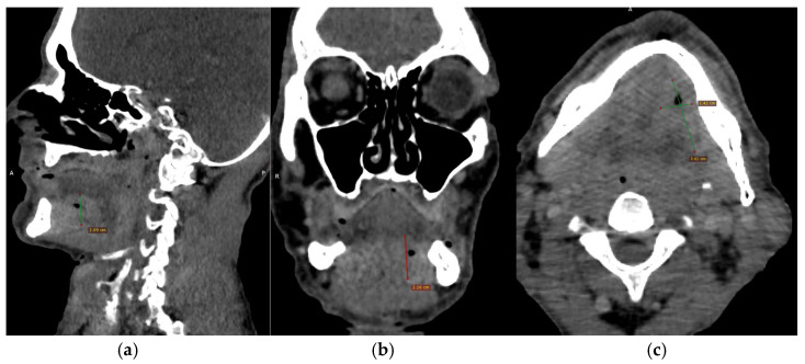 Figure 3