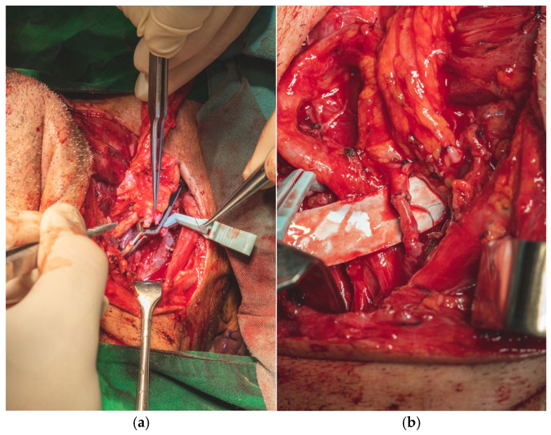 Figure 18