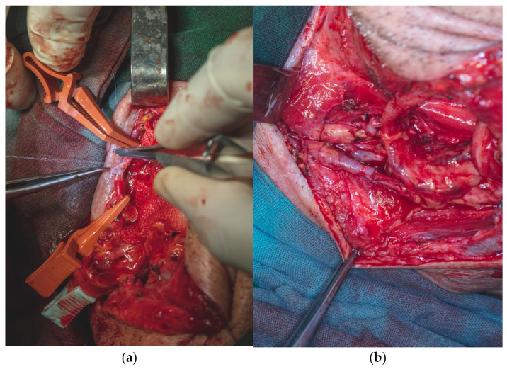Figure 19