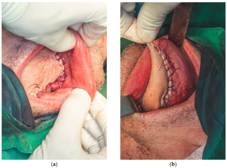Figure 20