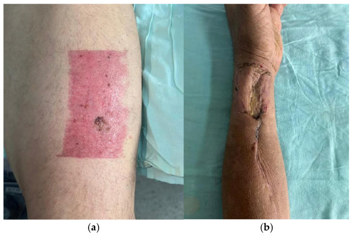 Figure 25