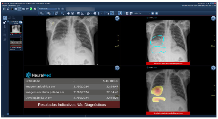 Figure 12