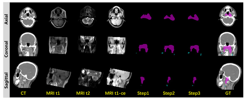 Figure 6