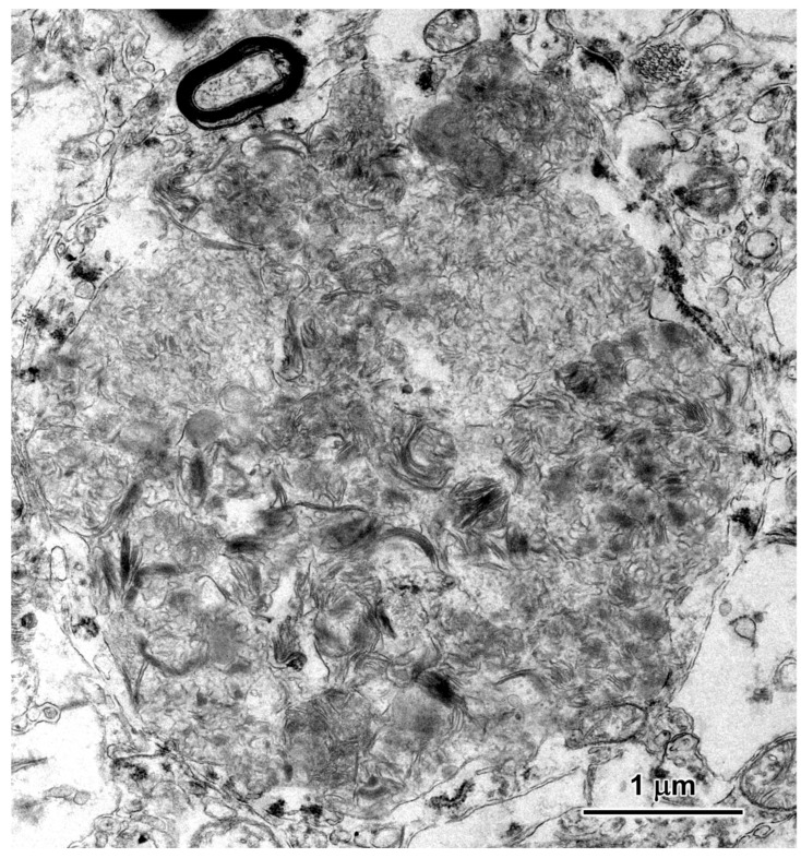 Figure 11