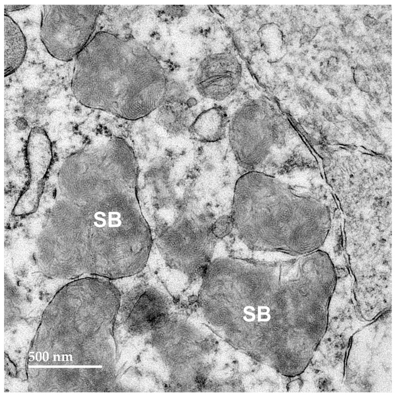 Figure 12