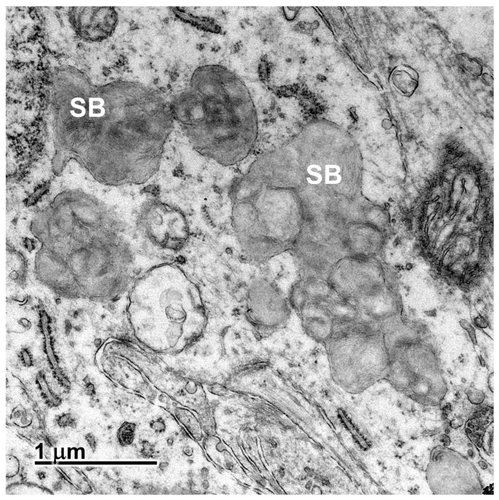 Figure 13