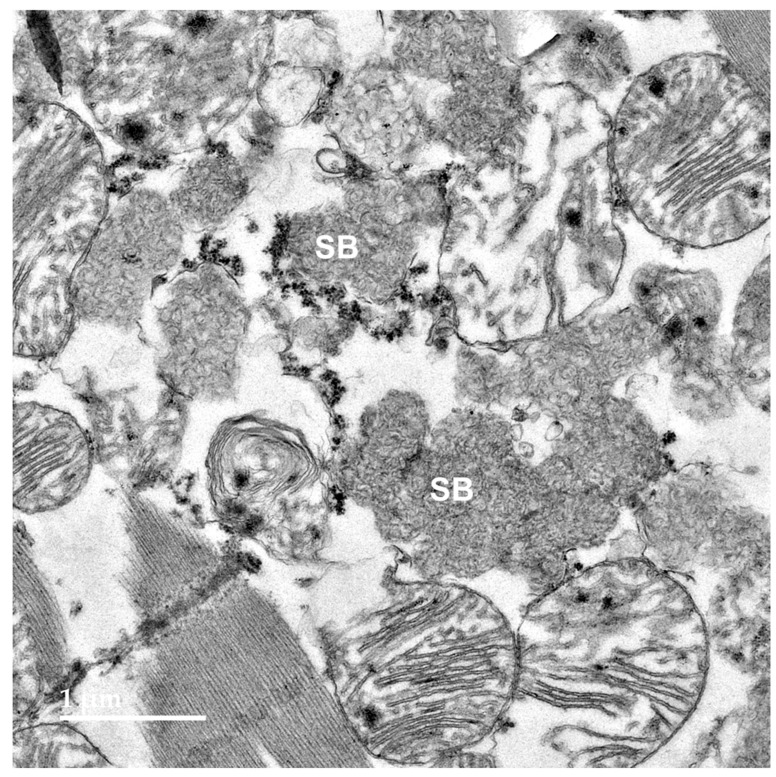 Figure 14