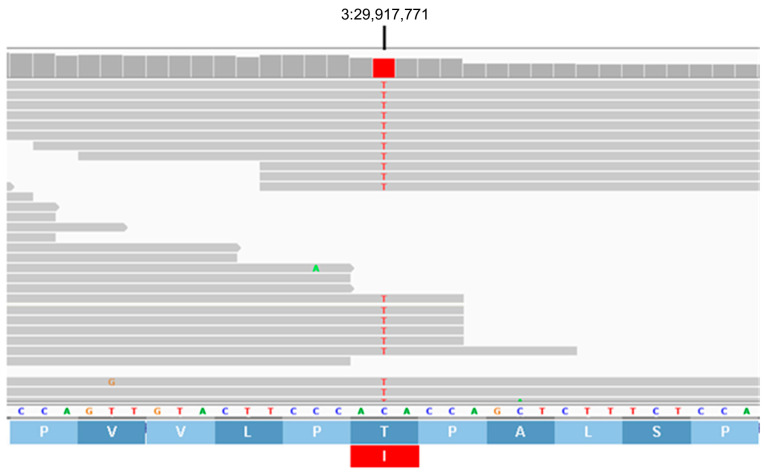 Figure 17