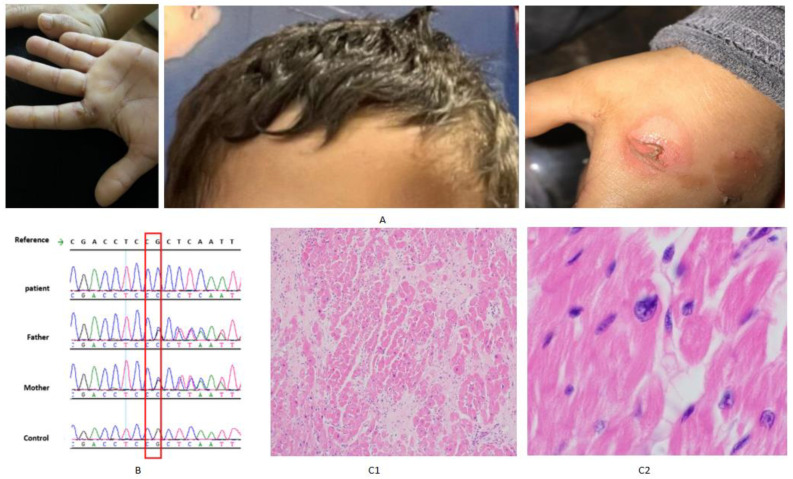 Figure 2
