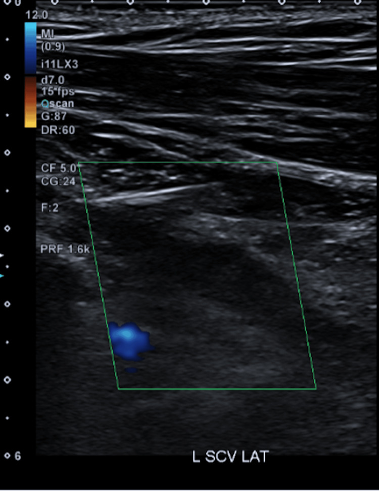 Figure 5