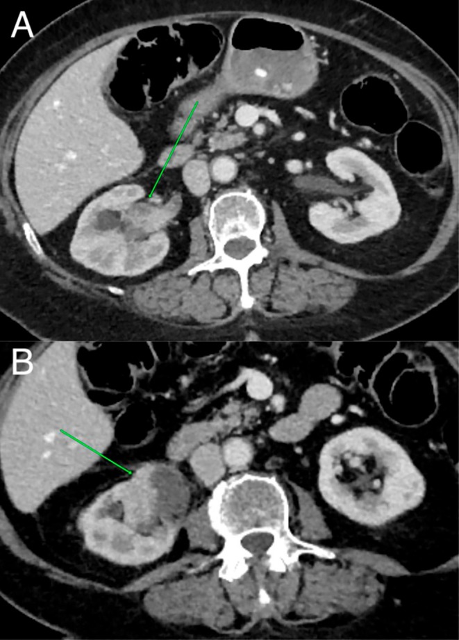 FIGURE 3