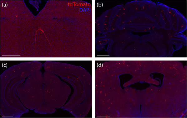 FIGURE 14