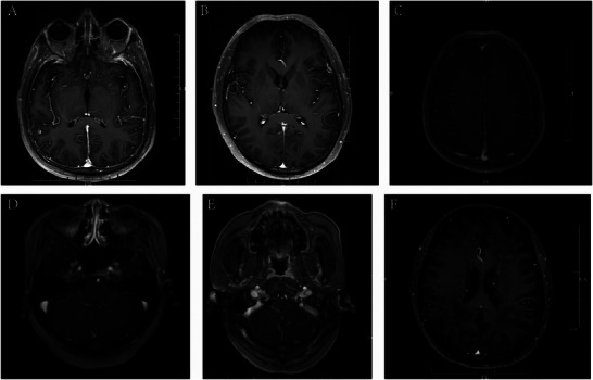 FIGURE 3