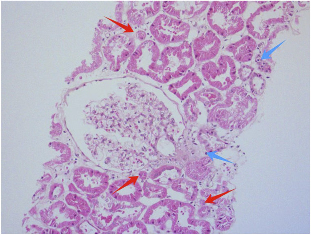 FIGURE 1