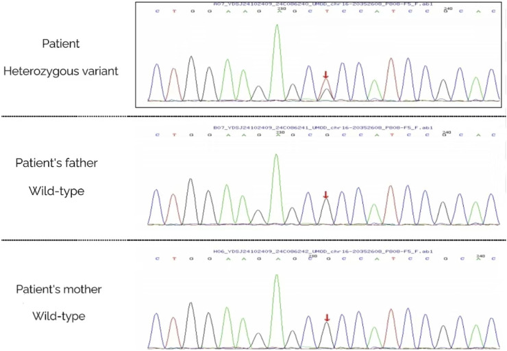 FIGURE 4