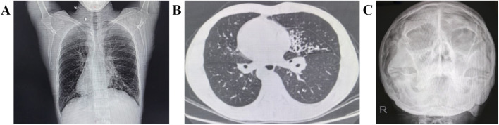 FIGURE 1