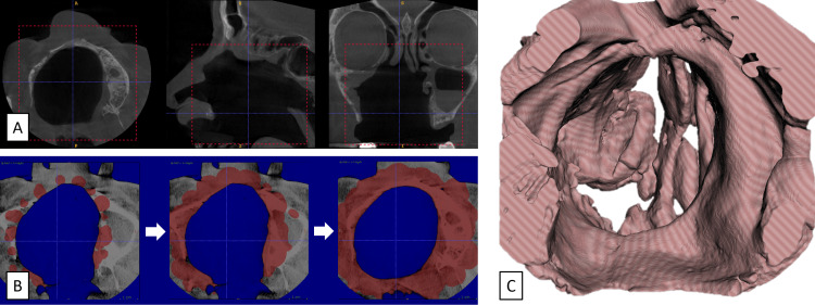 Figure 2