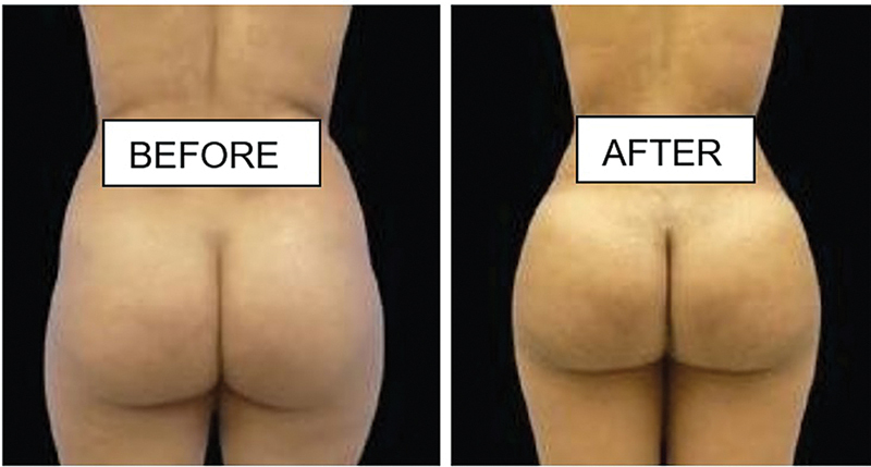 Fig. 8