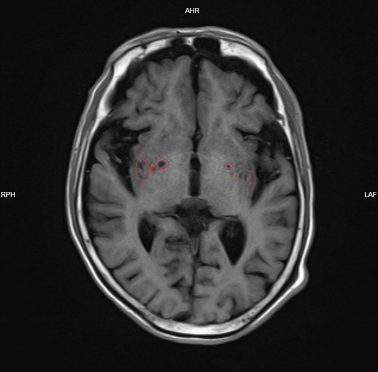 Figure 2