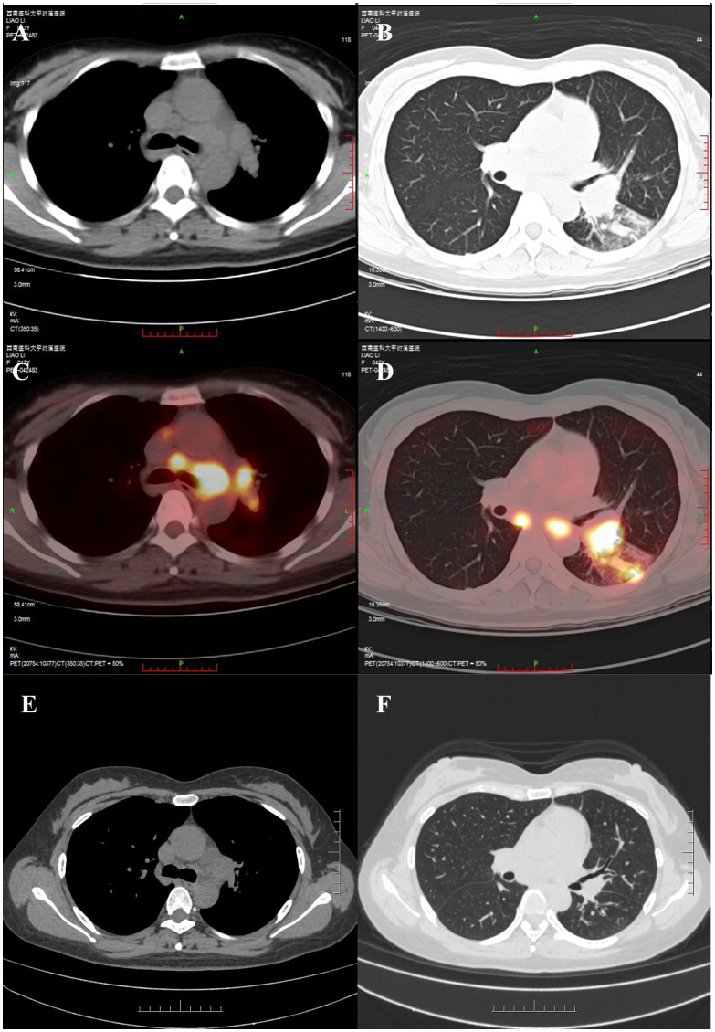 Figure 1