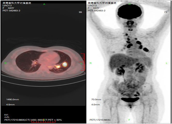 Figure 2