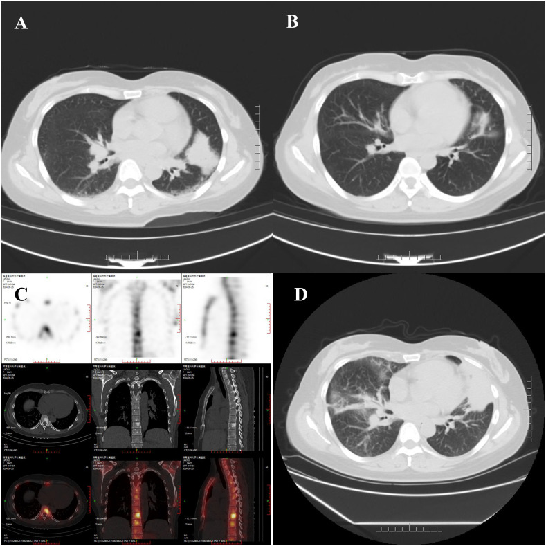 Figure 3