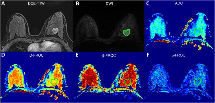 Figure 1