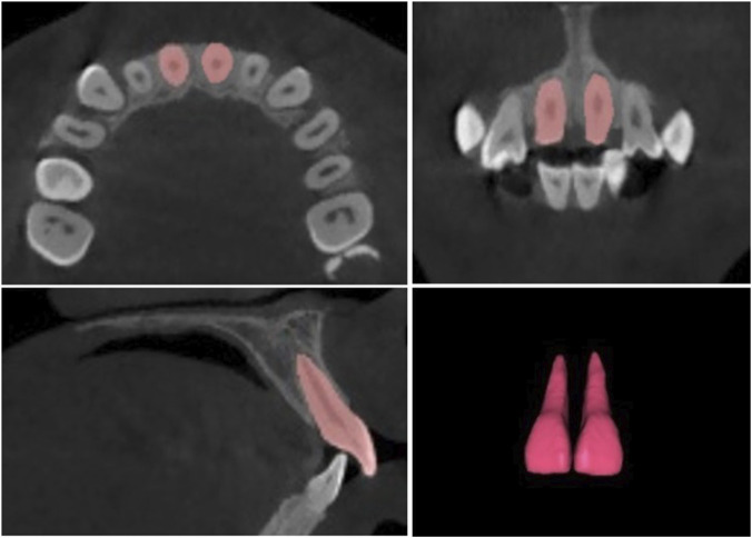 FIGURE 3