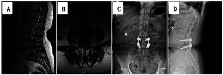 Figure 2