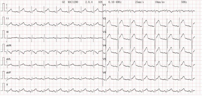 Figure 3