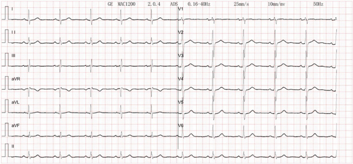 Figure 4
