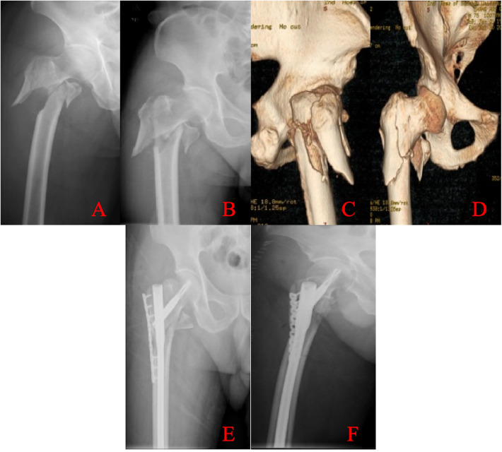 Figure 2
