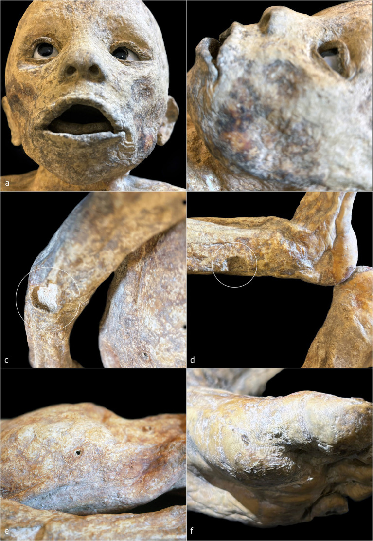 Figure 6
