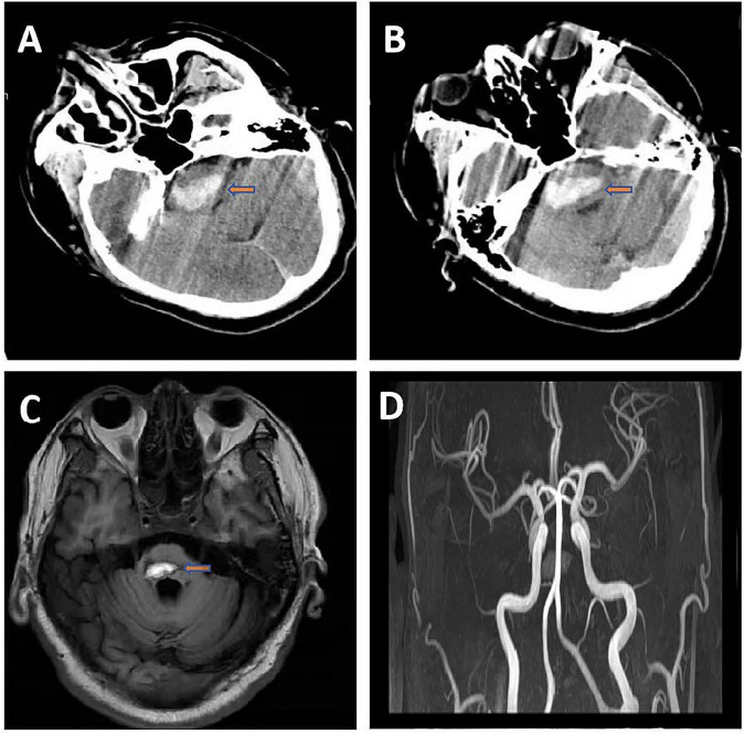 FIGURE 1
