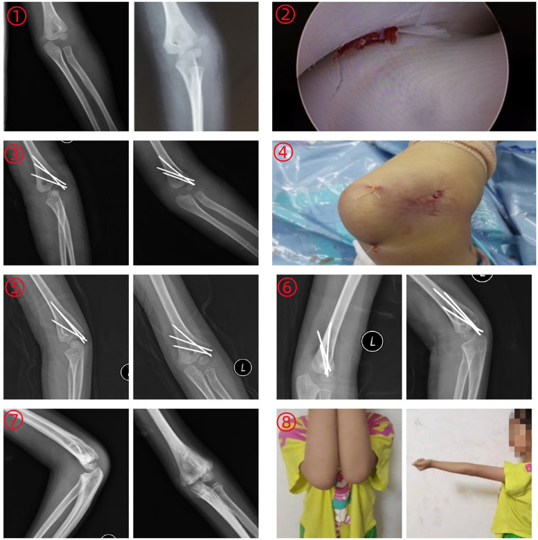 Figure 1