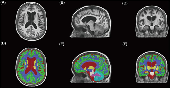 FIGURE 2