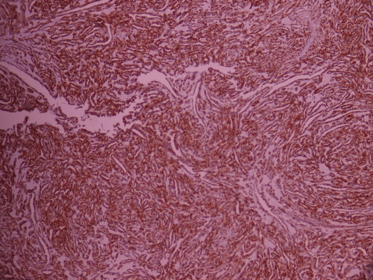 Figure 10