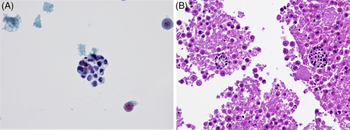 FIGURE 1