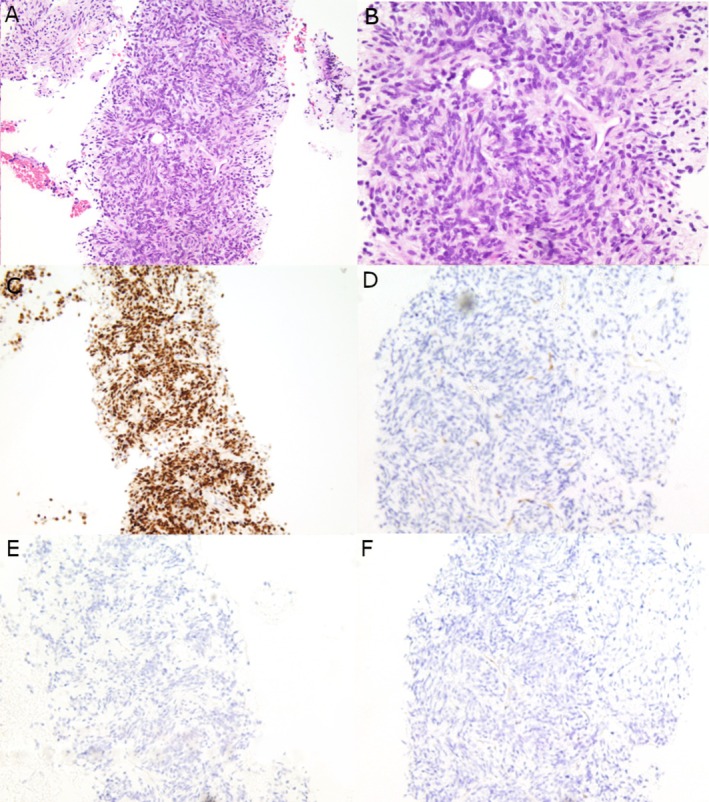 FIGURE 4