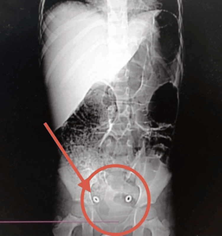 Figure 2