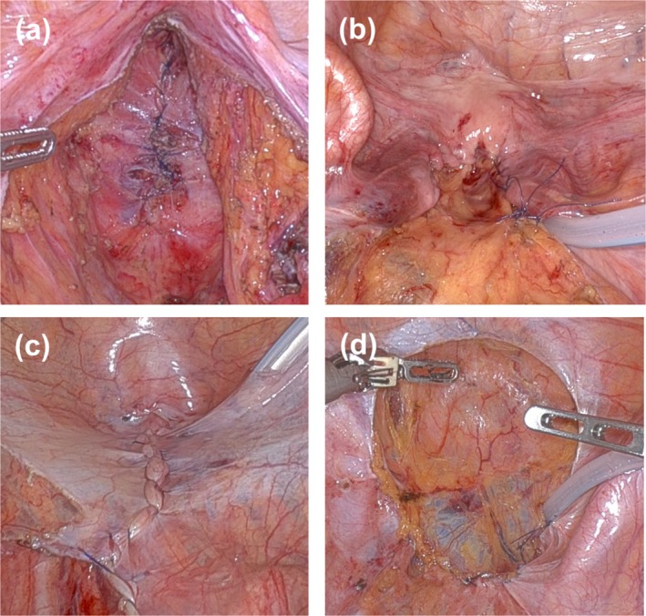 FIGURE 2