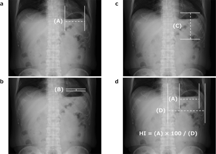 FIGURE 2