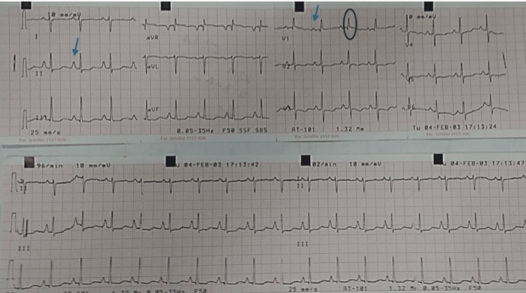 Figure 5