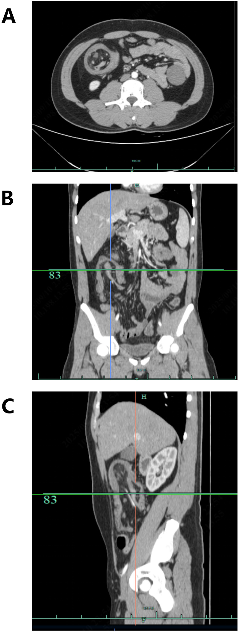 Figure 1