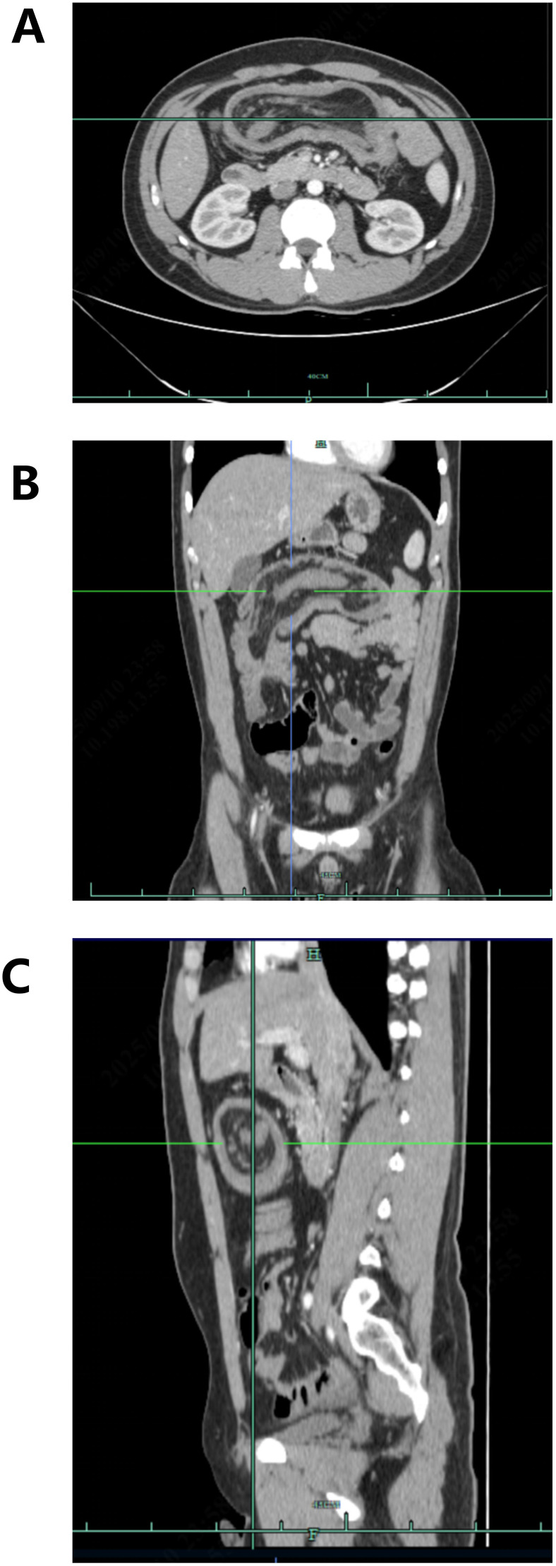 Figure 2