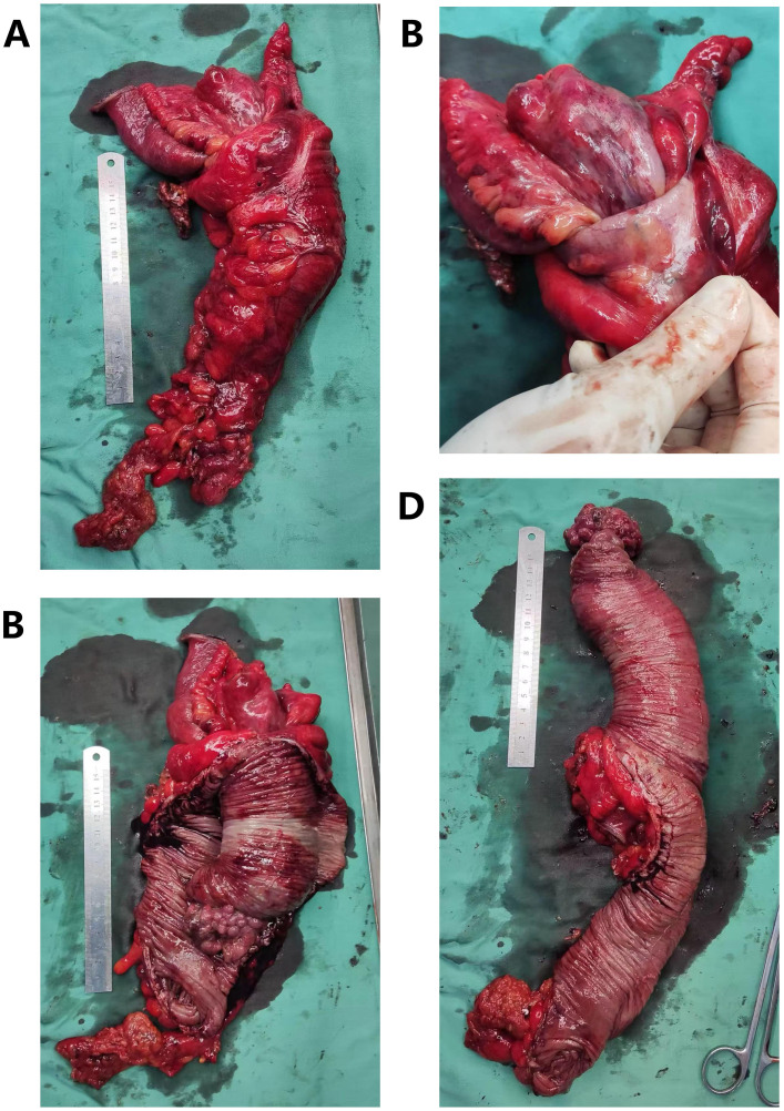 Figure 3